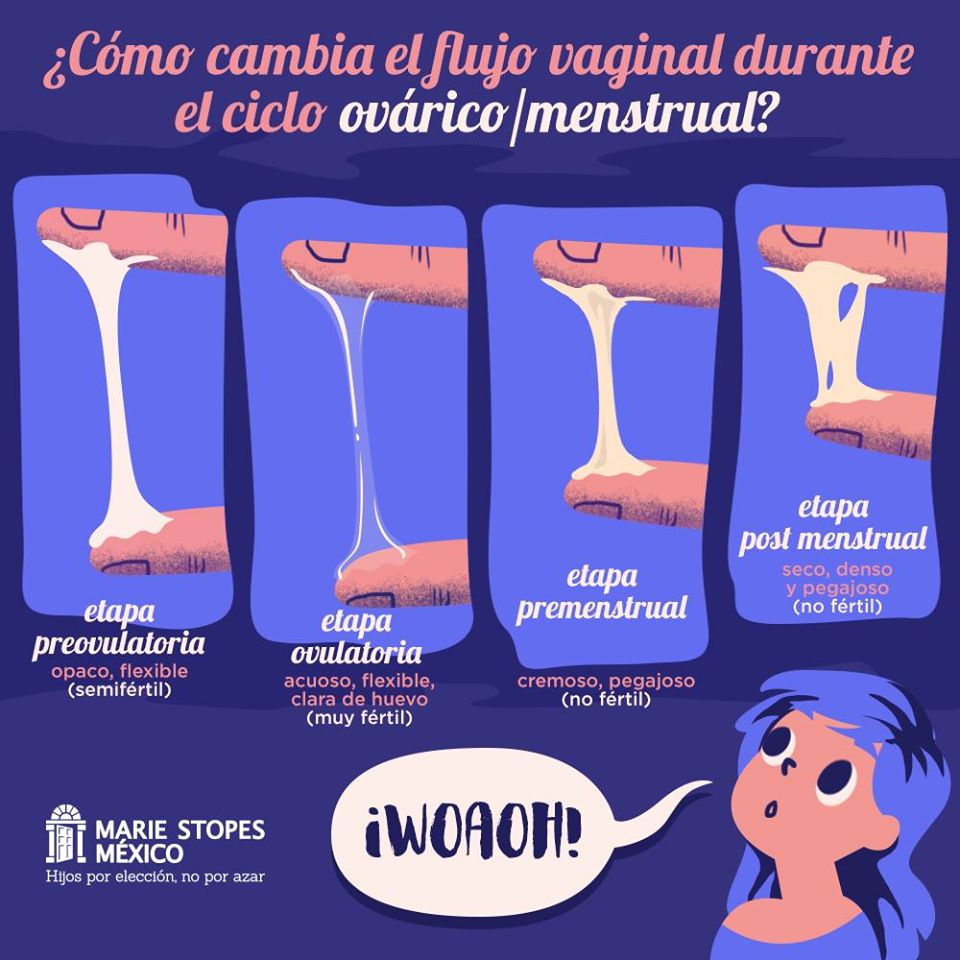 Flujo vaginal como requesón