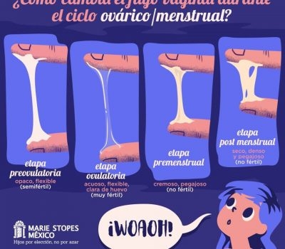 Flujo vaginal como requesón