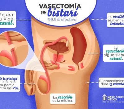 La vida en pareja en tiempos de la vasectomía