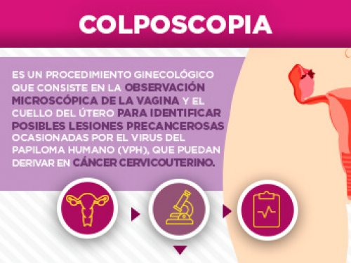 Colposcopia